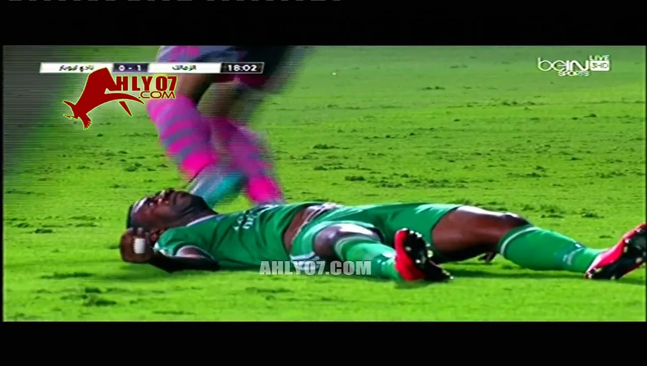 إصابة خطيرة للاعب ليوبار في مباراة الزمالك